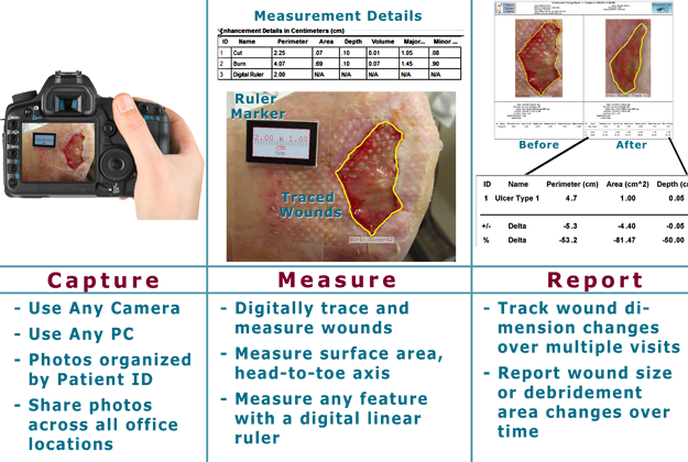 Workflow for Wound Measurement